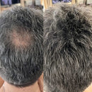 Camuflagem Capilar Profissional FixHair