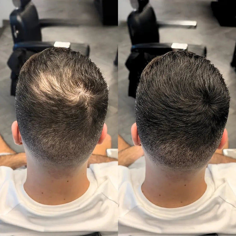 Camuflagem Capilar Profissional FixHair