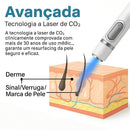Caneta Laser MediSkin™ – Remove Manchas e Verrugas sem Dor