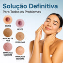 Caneta Laser MediSkin™ – Remove Manchas e Verrugas sem Dor