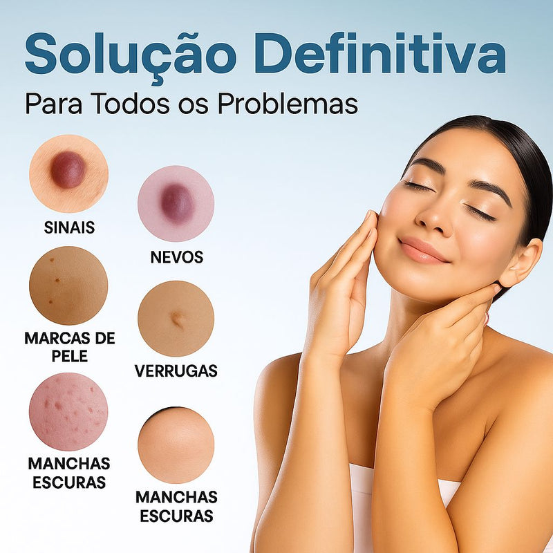 Caneta Laser MediSkin™ – Remove Manchas e Verrugas sem Dor