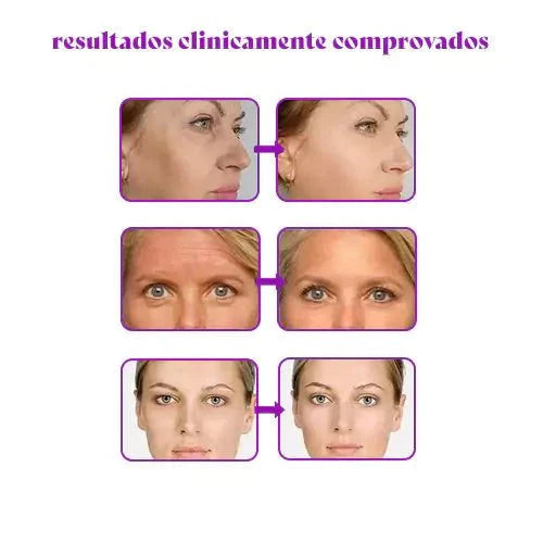 CollagenBoost - Máscara De Colágeno Que Revitalize e Renova a Pele