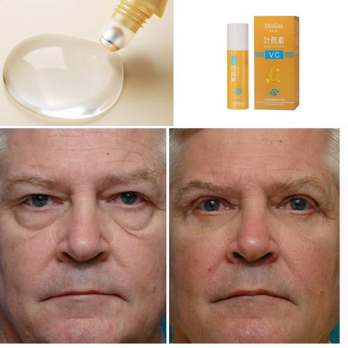 Rolon 5 em 1 Ultra Rejuvenescedor - Luteína Glow®