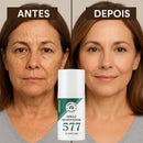 Spray Removedor de manchas de Sol, IDADE E MELASMA! Desconto+ Frete Grátis