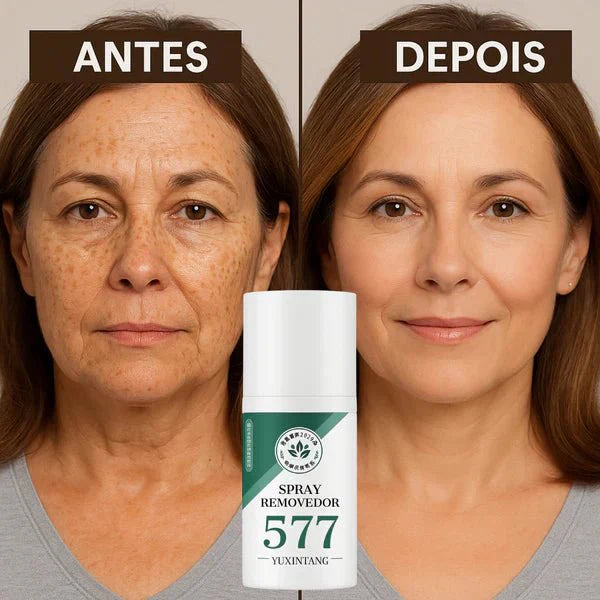 Spray Removedor de manchas de Sol, IDADE E MELASMA! Desconto+ Frete Grátis