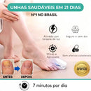 Unha Livre PRO – Solução Avançada para Unhas Saudáveis